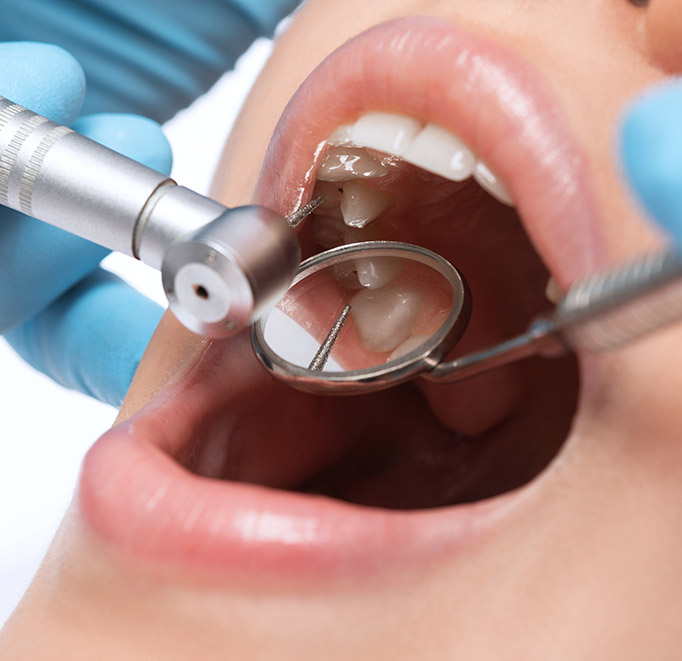 Cosmetic Dentist in Olathe