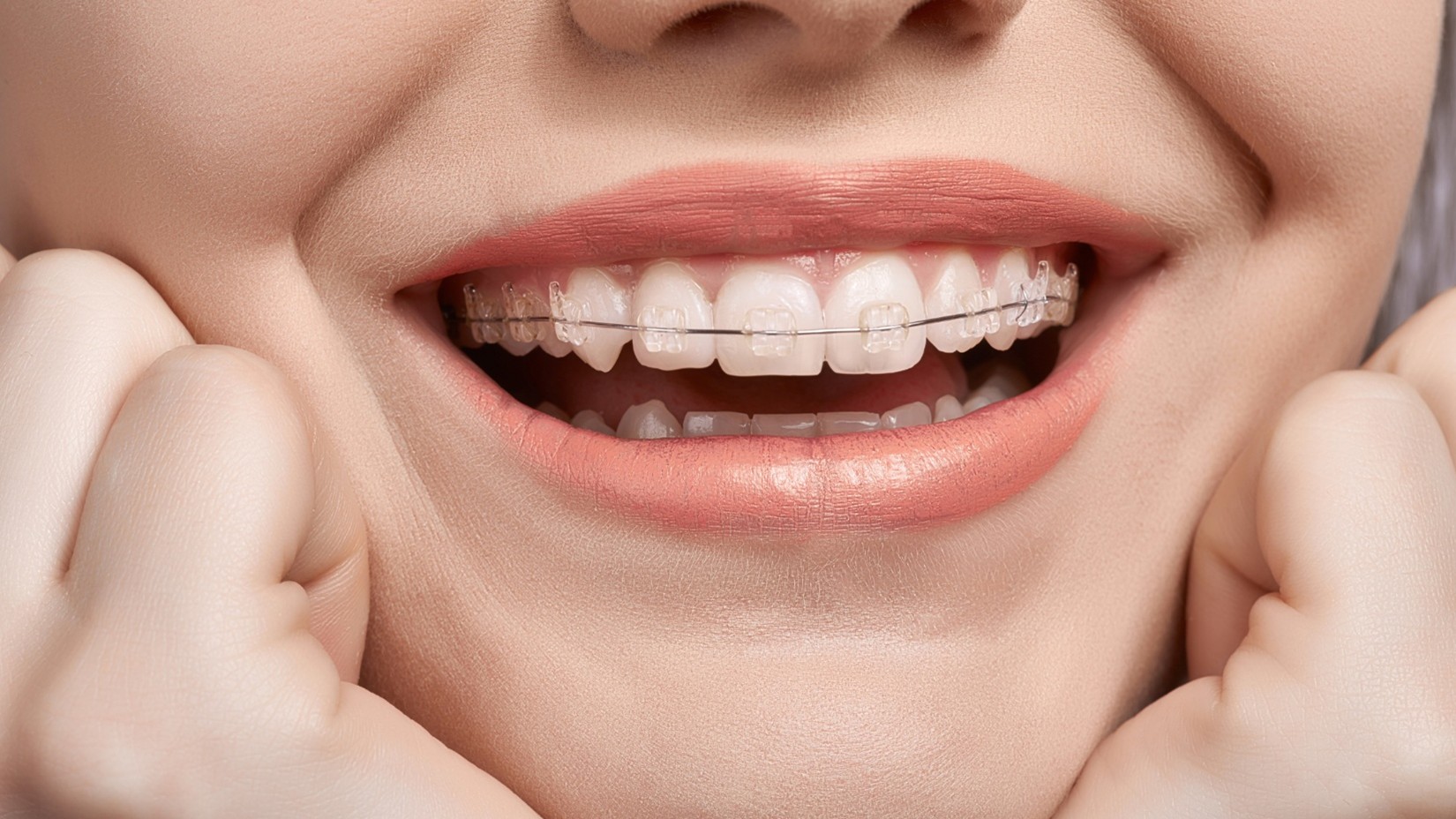 Preventative Dentistry in Olathe